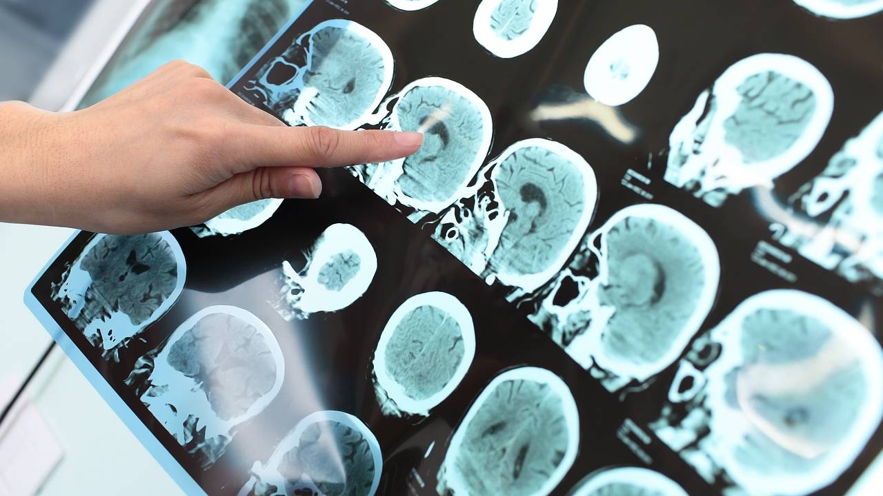 Ученые опровергли миф о неизбежном старении мозга
