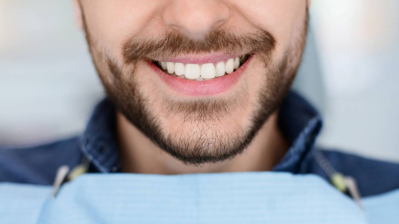 Россиянин сделал на отдыхе «голивудскую улыбку» и переделал ее за 1,5 миллиона рублей