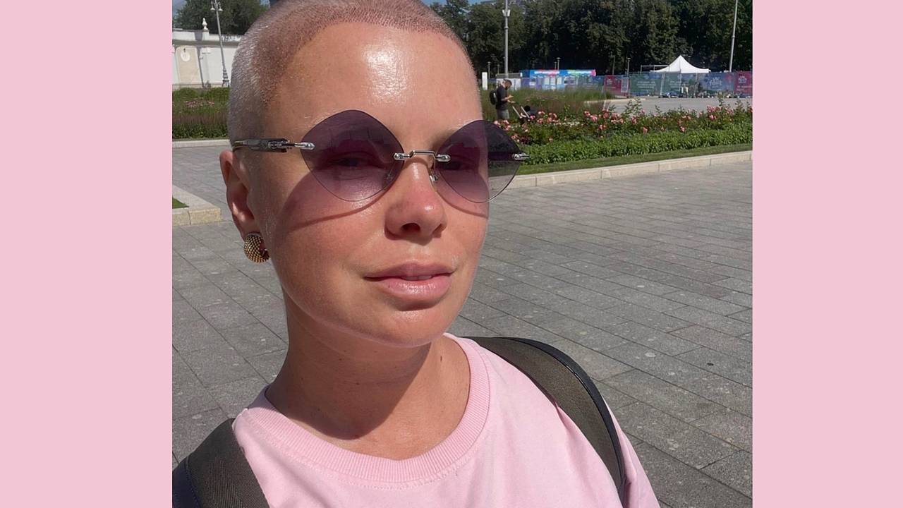 Известная российская актриса показала внешность после пересадки волос Известная российская актриса показала внешность после пересадки волос